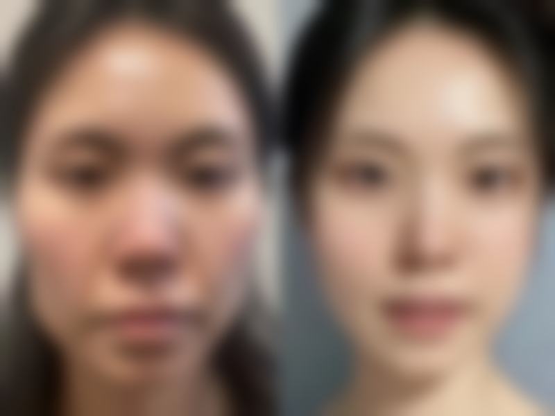 廊坊蓝天医院医疗美容科正规吗?