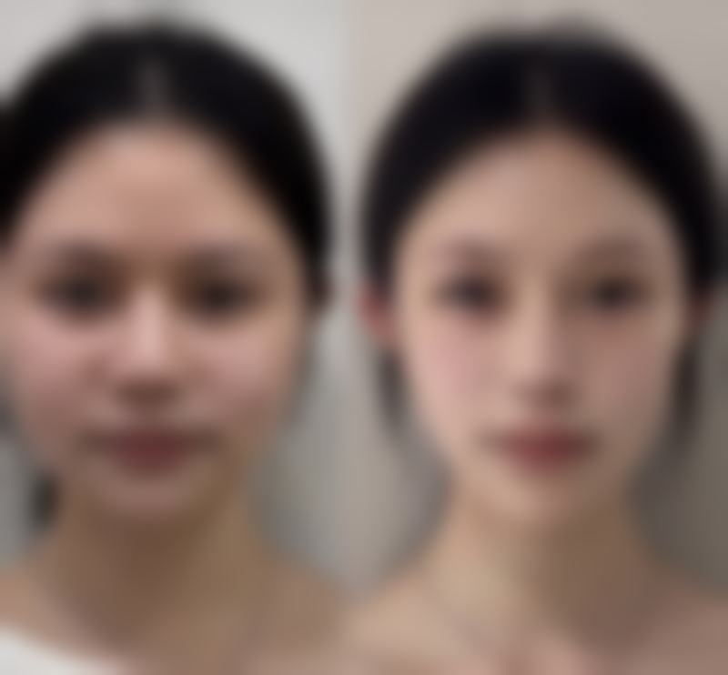 四平市铁西区微风医疗美容诊所怎么预约
