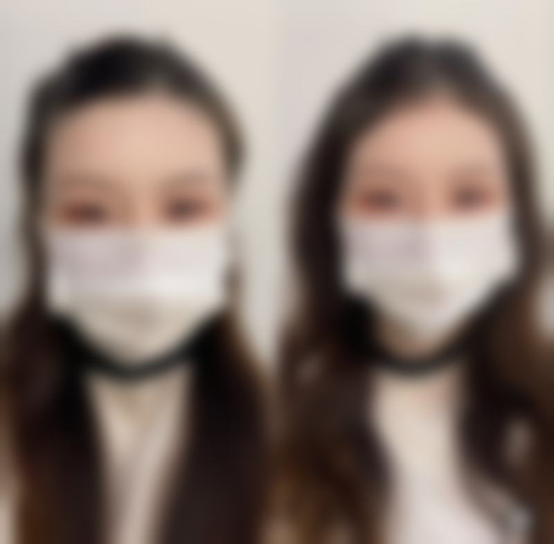 烟台三有整形美容医院尤克济医生患者评价