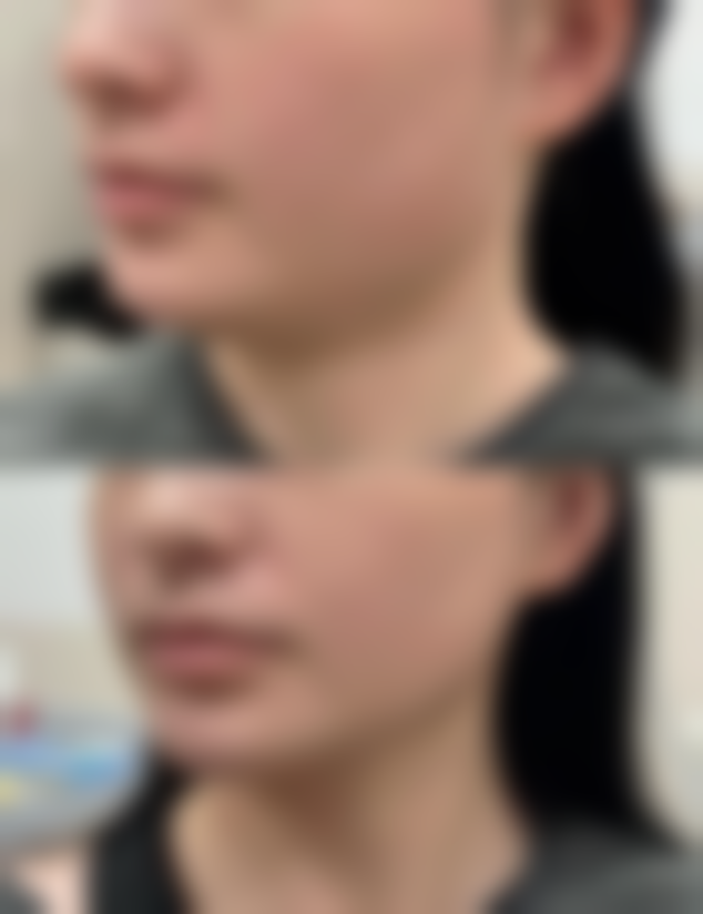 成都出色天使整形医疗美容诊所口碑评价怎么样?