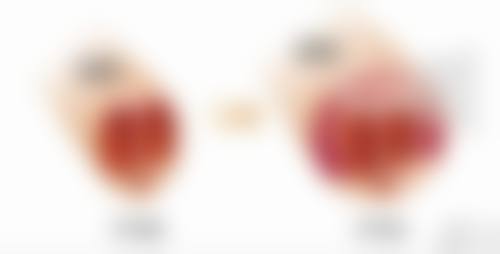 上海伊美尔整形美容医院正规吗?