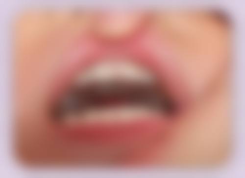 临床实例分享