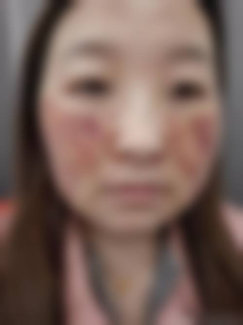 临床实例分享