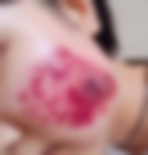 安阳苏莱美美容擅长项目。