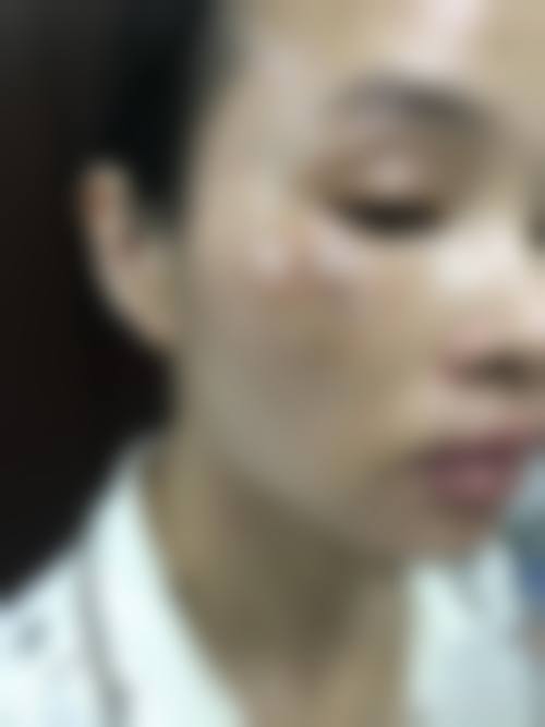 东莞罗恩医疗美容门诊部预约挂号方式。