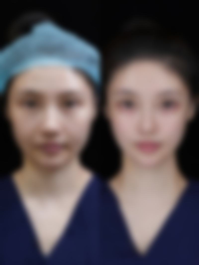 擅长项目详解