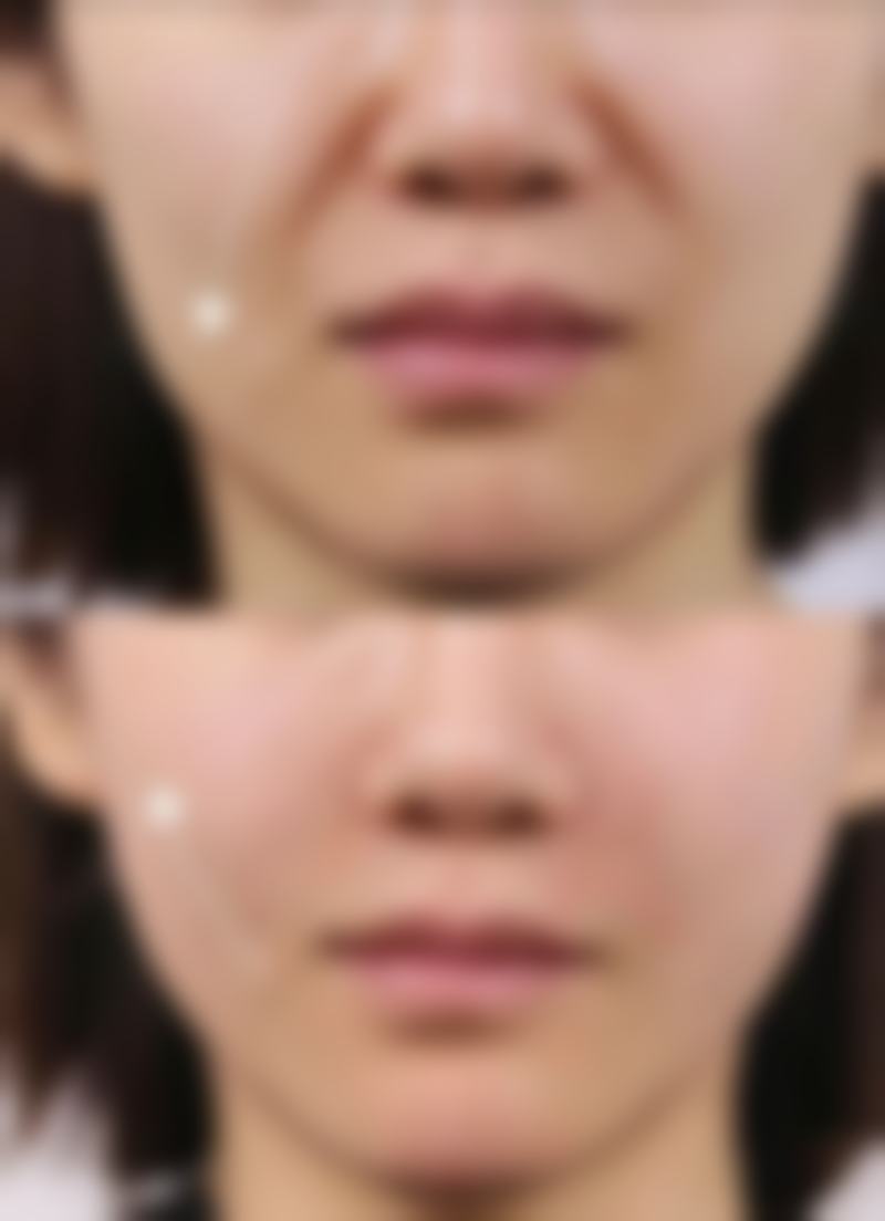 南宁美恒医疗美容正规吗？