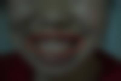 擅长项目详解