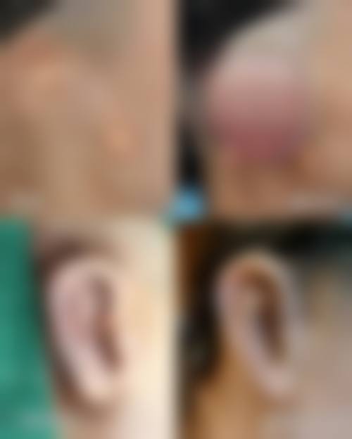 擅长项目详解