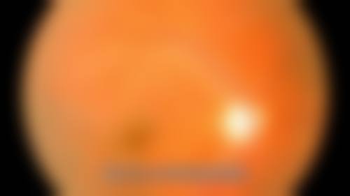 特色科室与项目：专注儿童青少年近视防控