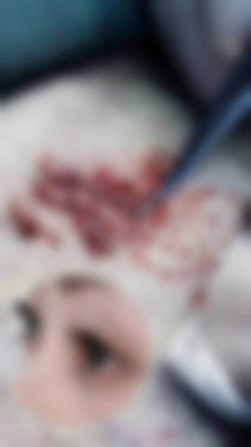 患者真实评价