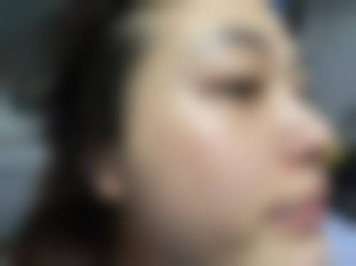 TU牙科医院治疗反馈与口碑评价。