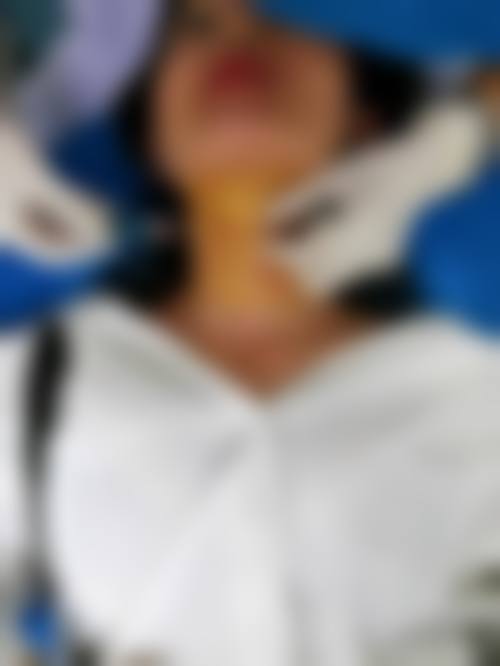 梅州诺丽医疗美容擅长项目。