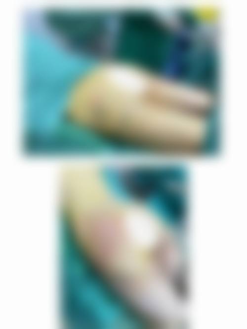 六盘水妍僖整形医院门诊营业时间