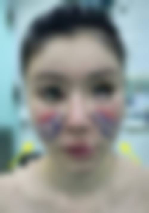 六盘水妍僖整形医院项目优势