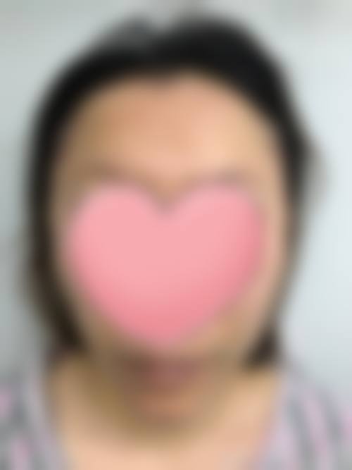 成都美未央医疗美容2026年价格收费表: