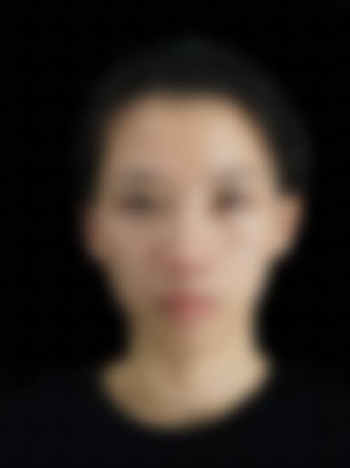 成都美未央医疗美容擅长项目。