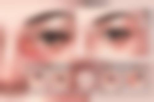 牡丹江市第二人民医院眼科预约挂号方式。