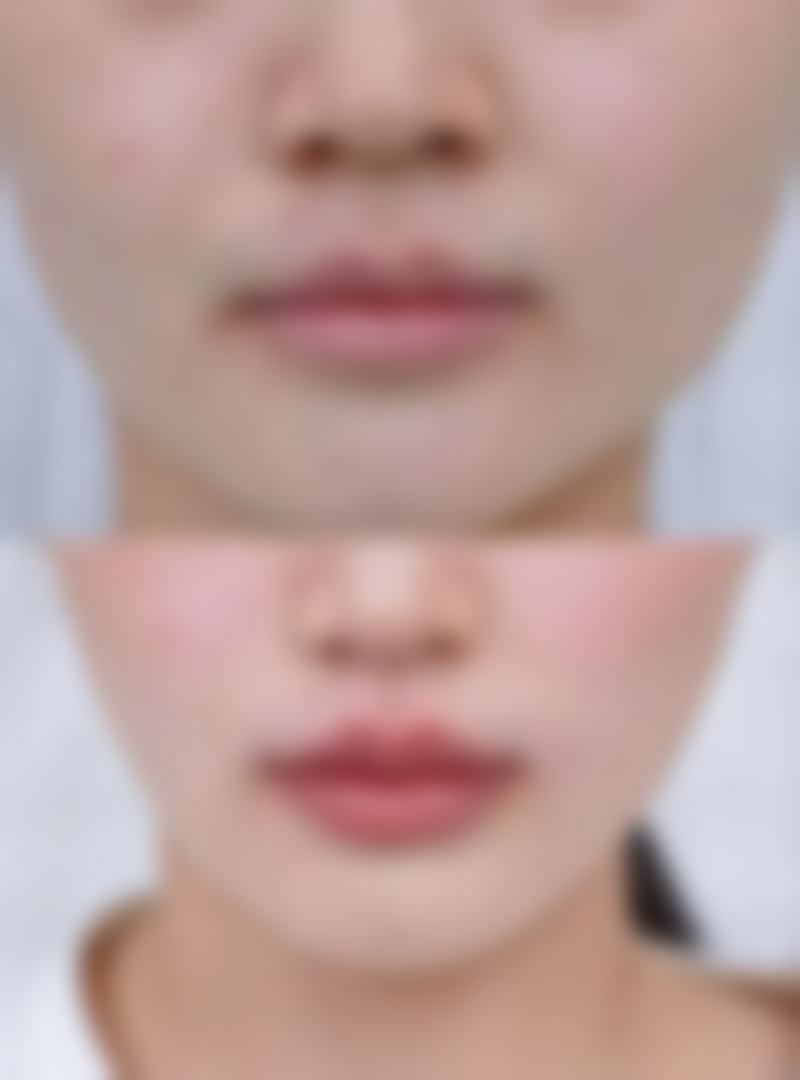 西安洛颜记医疗美容医院正规吗?