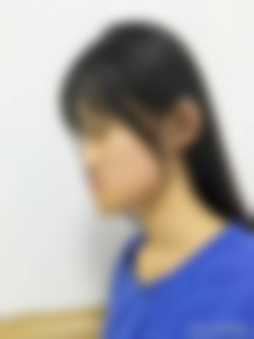 权圣凤医生的技术实力