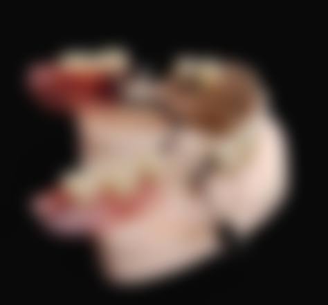 临床实例分享