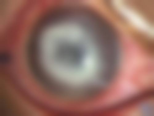来宾市人民医院眼科医生团队经验稳定。