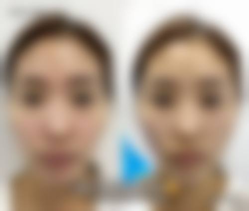 顺德容桂贝尔美医疗美容专科医院擅长项目。