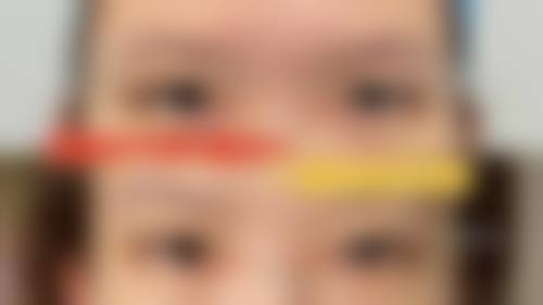遵义市红花岗区人民医院眼科2026年价格收费表: