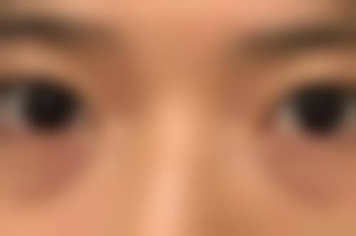 总结