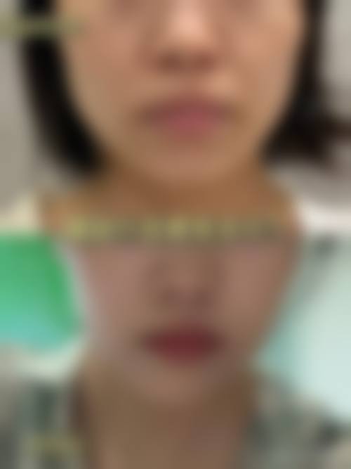 总结与预约号召