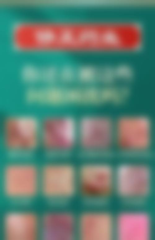 患者真实评价