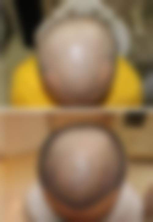 总结