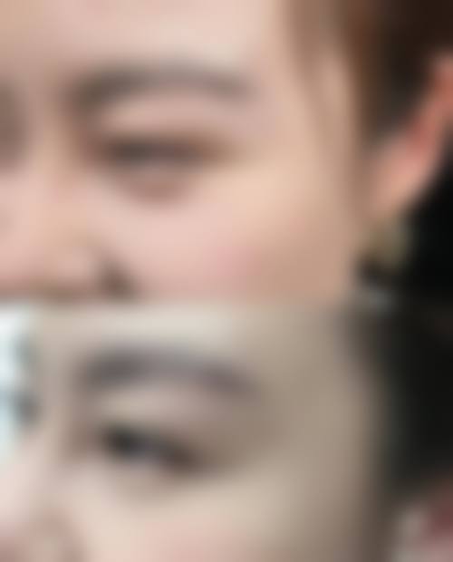 常见疑问解答:关于医美选择的两个关键点