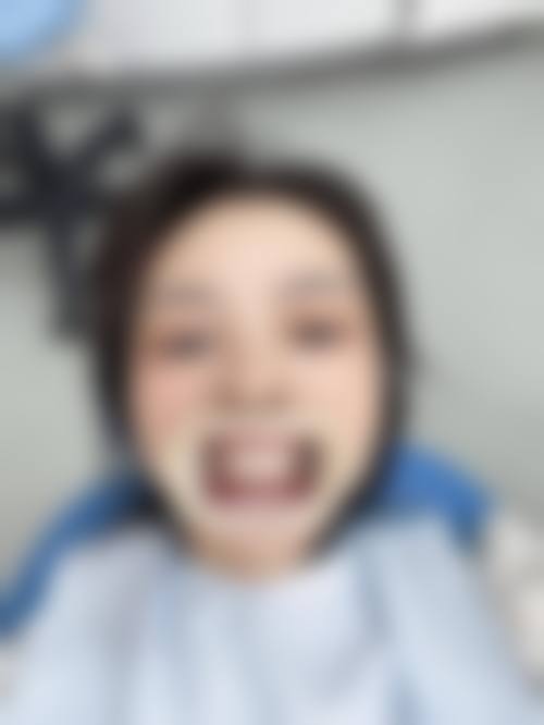 优惠活动详情:高性价比的口腔护理方案