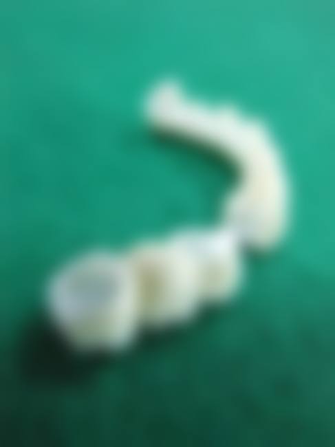 总结