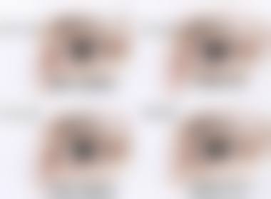 南京市第二医院眼科擅长项目。