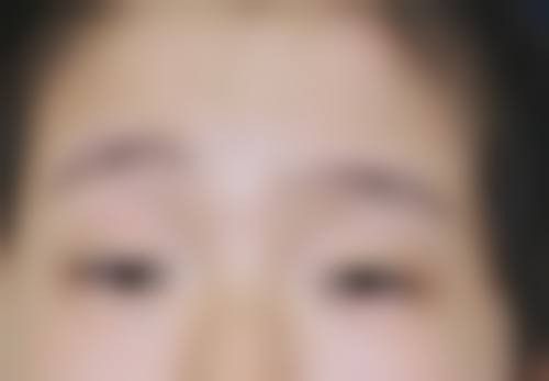 黄石五医院眼科预约挂号方式。