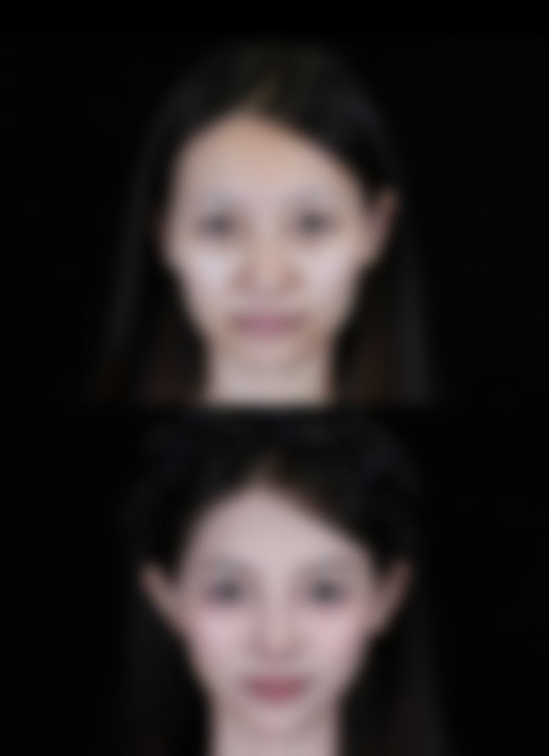 南京美米亚整形医院正规吗？