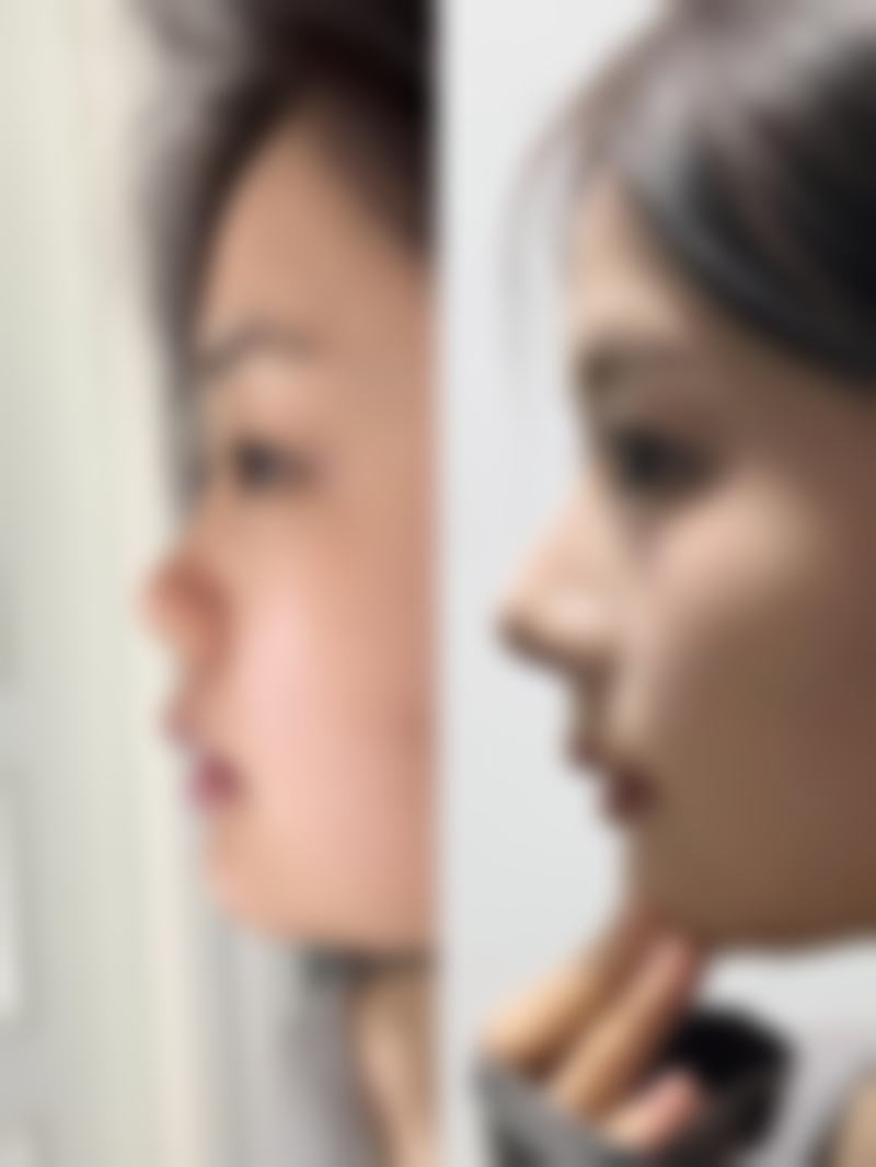 韩国101整形外科医院怎么预约